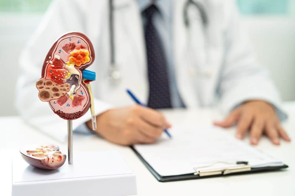 Modelo anatômico de rim em consultório médico, representando pesquisa clínica em doença renal crônica e novos tratamentos experimentais.